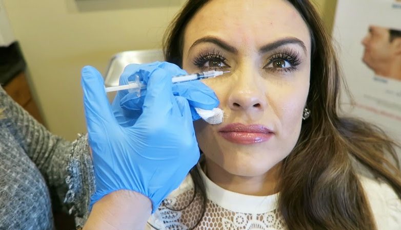 My Botox Experience| Synergy Plastic Surgery