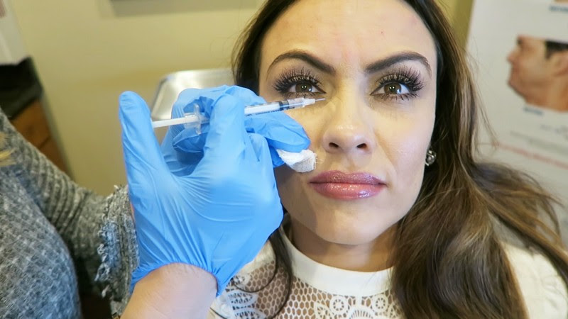 My Botox Experience| Synergy Plastic Surgery