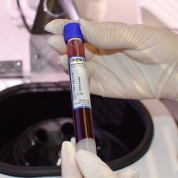 MY TOP HEALTHY ANTI-AGING HABITS| VIDEO