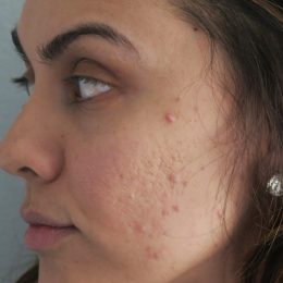 I Got A Personal Trainer!! | Absolute Fitness By TJ