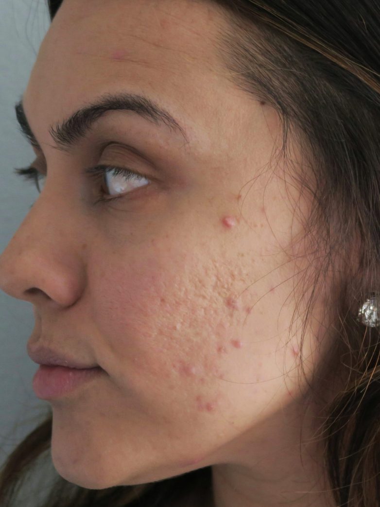 I Tried Kourtney Kardashians Beauty Secret!!!